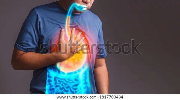 Barrett's Esophagus